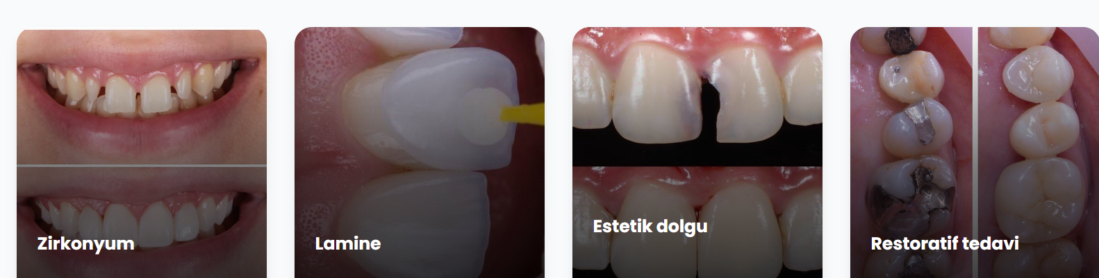Ekip Çalışması